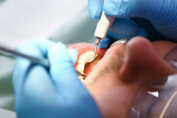 Best Broken or Chipped Tooth Repair in Kekaha, HI